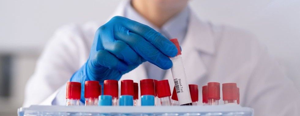 analiza krwi u sportoców